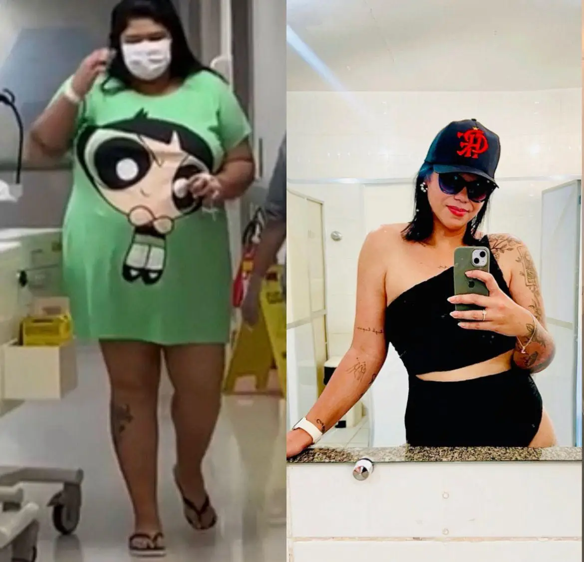 Emagrecimento - Resultados - Antes e Depois - Clínica LS - RJ